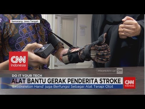 Inovasi Alat Bantu Gerak untuk Penderita Stroke