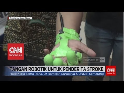 RSAL & UNDIP Kembangkan Tangan Robot Bantu Penderita Stroke & Lumpuh Tangan