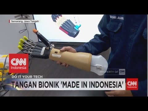 Tangan Bionik 'Made in Indonesia'