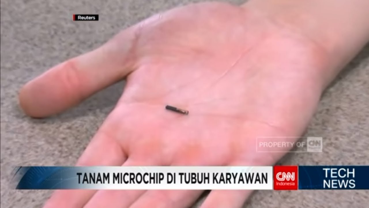 Tanam Microchip di Tubuh Karyawan - TechNews