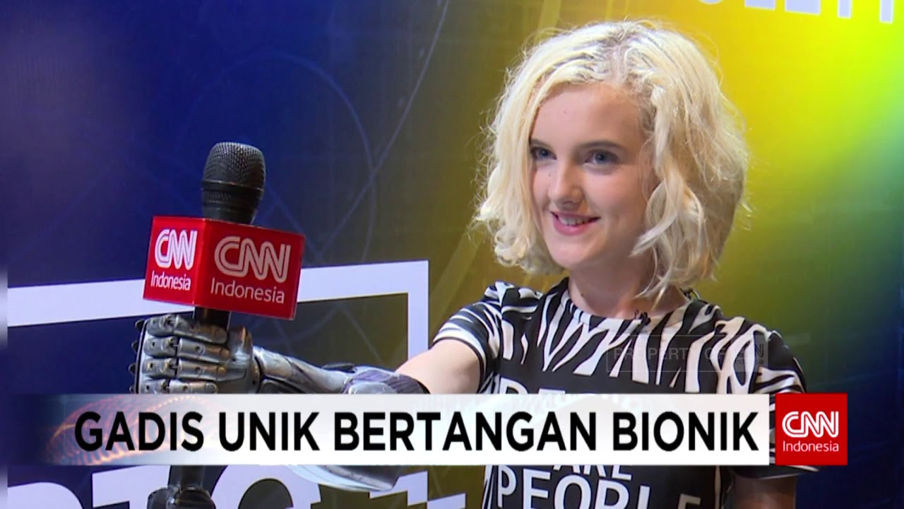 Tilly Locky, Gadis Inggris Bertangan Bionik