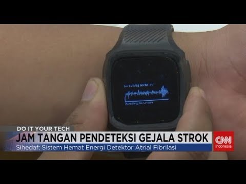 Jam Tangan Pendeteksi Gejala Strok